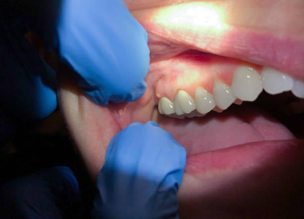 Best Emergency Care for Gum Disease in Ripley, TN